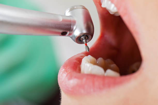 Best Affordable Emergency Dental Care  in Mcqueeney, TX
